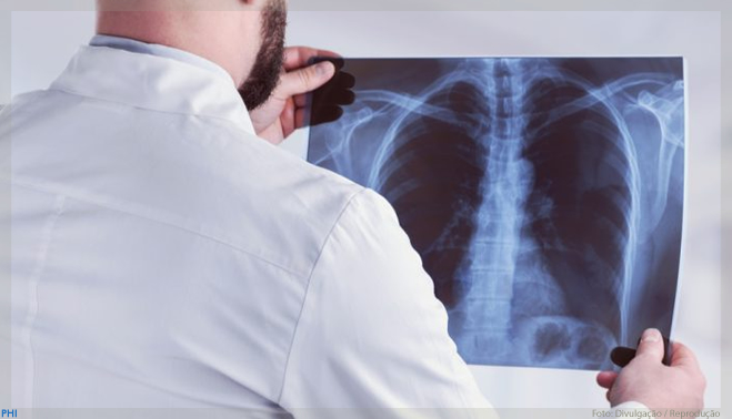 Anvisa aprova Evobrig (brigatinibe) para pacientes com câncer de pulmão metastático