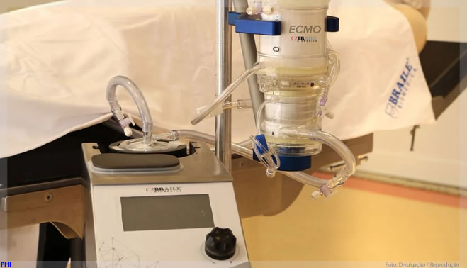 Anvisa registra pulmão artificial auxiliar em insuficiência respiratória