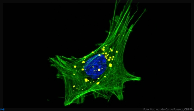 Estudo revela como o desequilíbrio da microbiota intestinal pode levar à doença de Parkinson