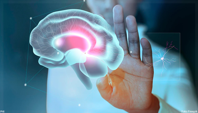 Mayo Clinic utiliza IA para mapear cérebros de pacientes com Alzheimer