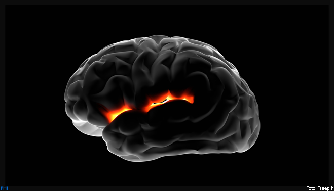 Estudo desvenda mecanismo de câncer cerebral pediátrico raro e aponta caminho para tratamento