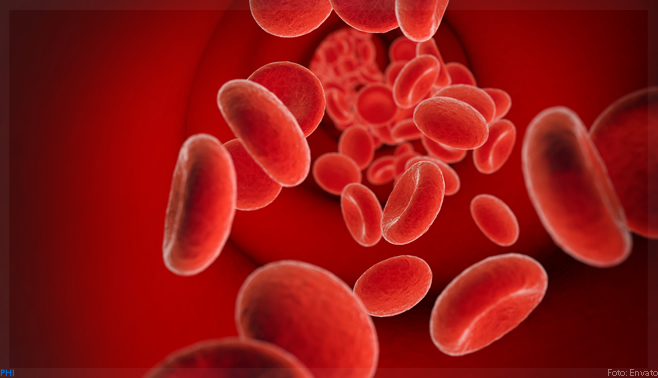 Sistema imune de pacientes com anemia falciforme melhora após transplante de células-tronco