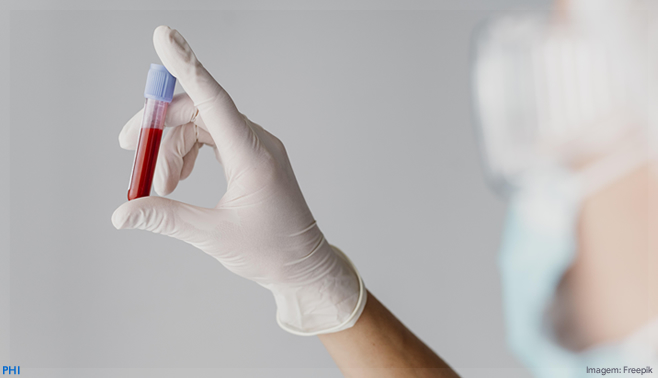 Ministério da Saúde distribui novo medicamento para pacientes com HIV