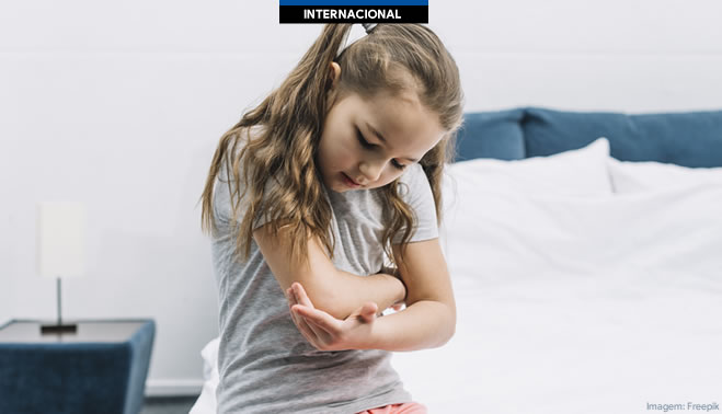 Dupixent aprovado na UE como o 1º medicamento para tratar crianças com urticária espontânea crônica